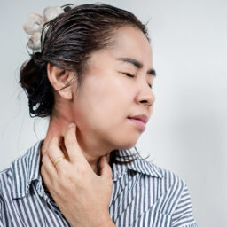 Woman with a skin allergy scratching her neck.